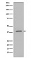 Anti-Phospho-IKB alpha (S32) NFKBIA Rabbit Monoclonal Antibody